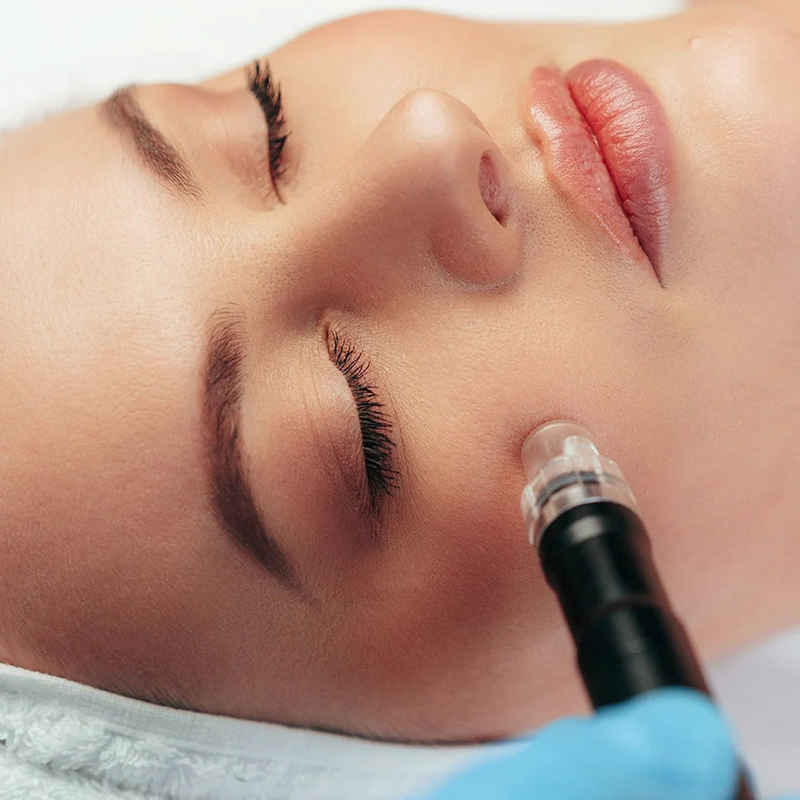 How Often Should You Do Hydra Pen Microneedling? Deluxe Laser & Aesthetics Guide for SA