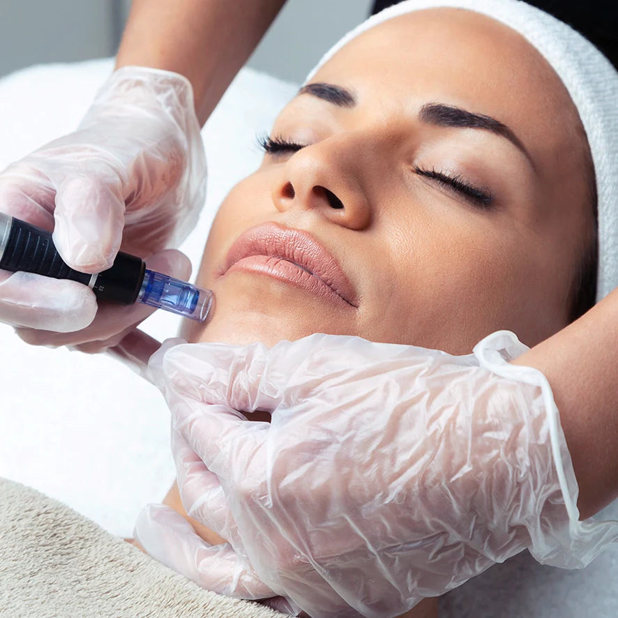 Ideal Microneedling Frequency: Your Guide to Maximum Results
